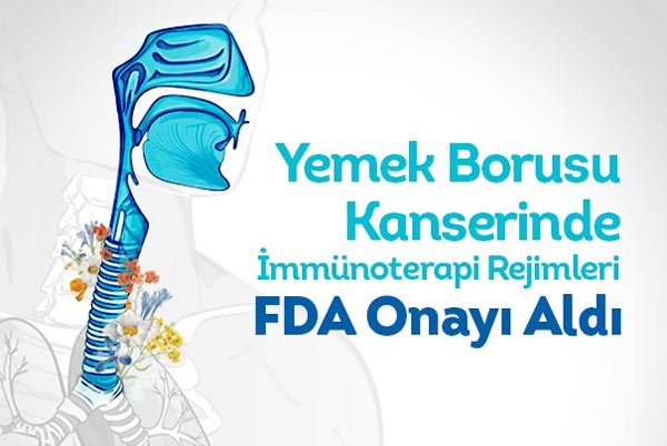 YEMEK BORUSU KANSERİNDE İMMÜNOTERAPİ FDA ONAYI ALDI